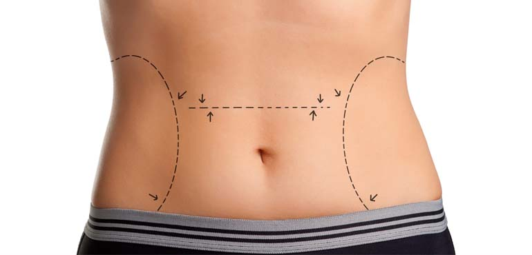 Cirurgia plástica: cuidados pré-operatórios