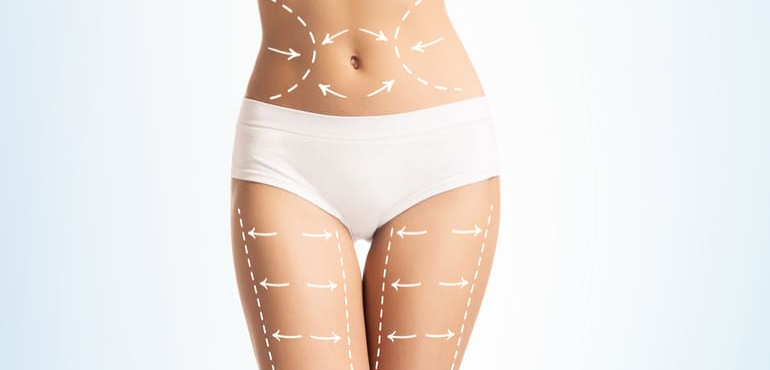 Conheça as principais diferenças entre lipoescultura e lipoaspiração